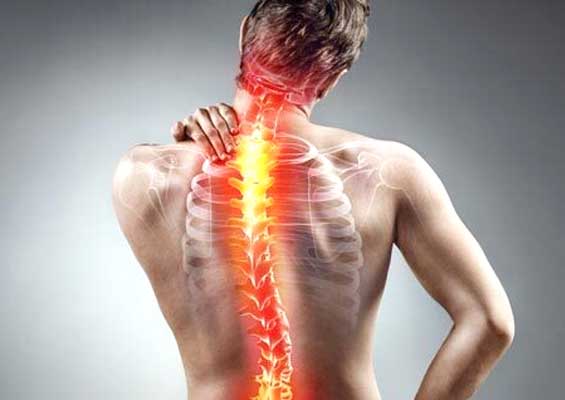 Spondylitis